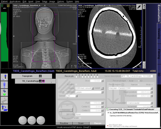 Siemens Healthcare Computed Tomography testing